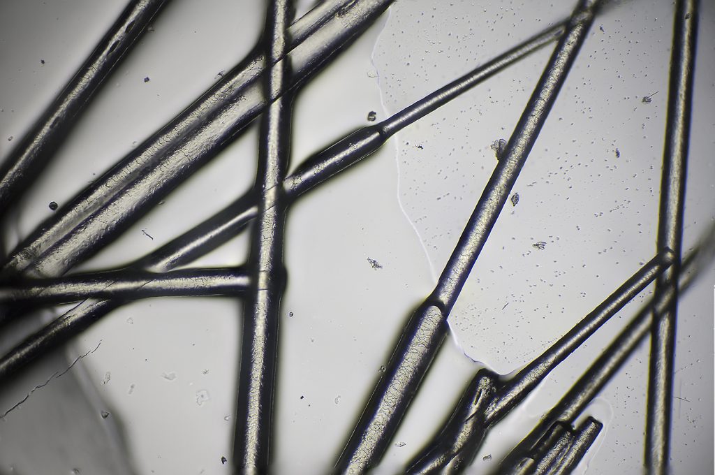 Mikroskooppikuvauksella saadaaan jopa tuhatkertainen suurennos kuvauskohteesta.